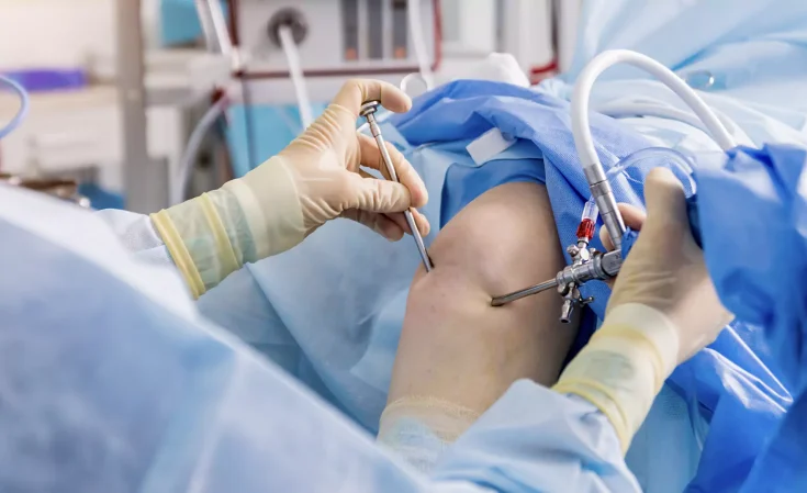 arthroscopy